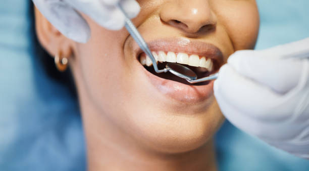 Best Emergency Dentist for Lost Fillings or Crowns in Bartonvle, IL
